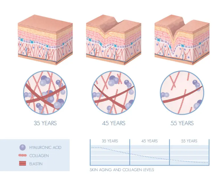 Less hyaluronic acid and collagen with age