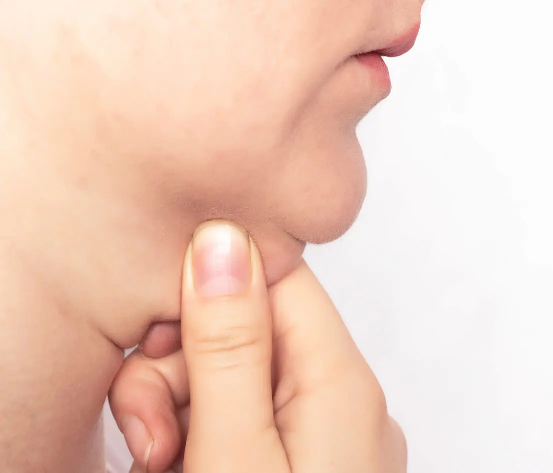 Liposuzione del collo e collo tonico a Berlino