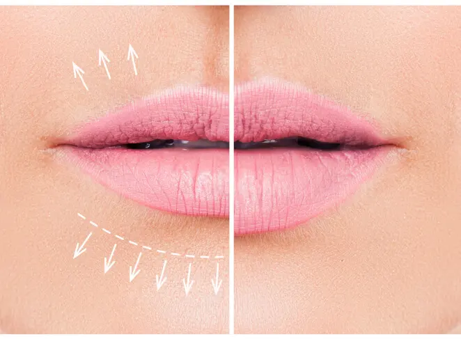 Russian Lips
