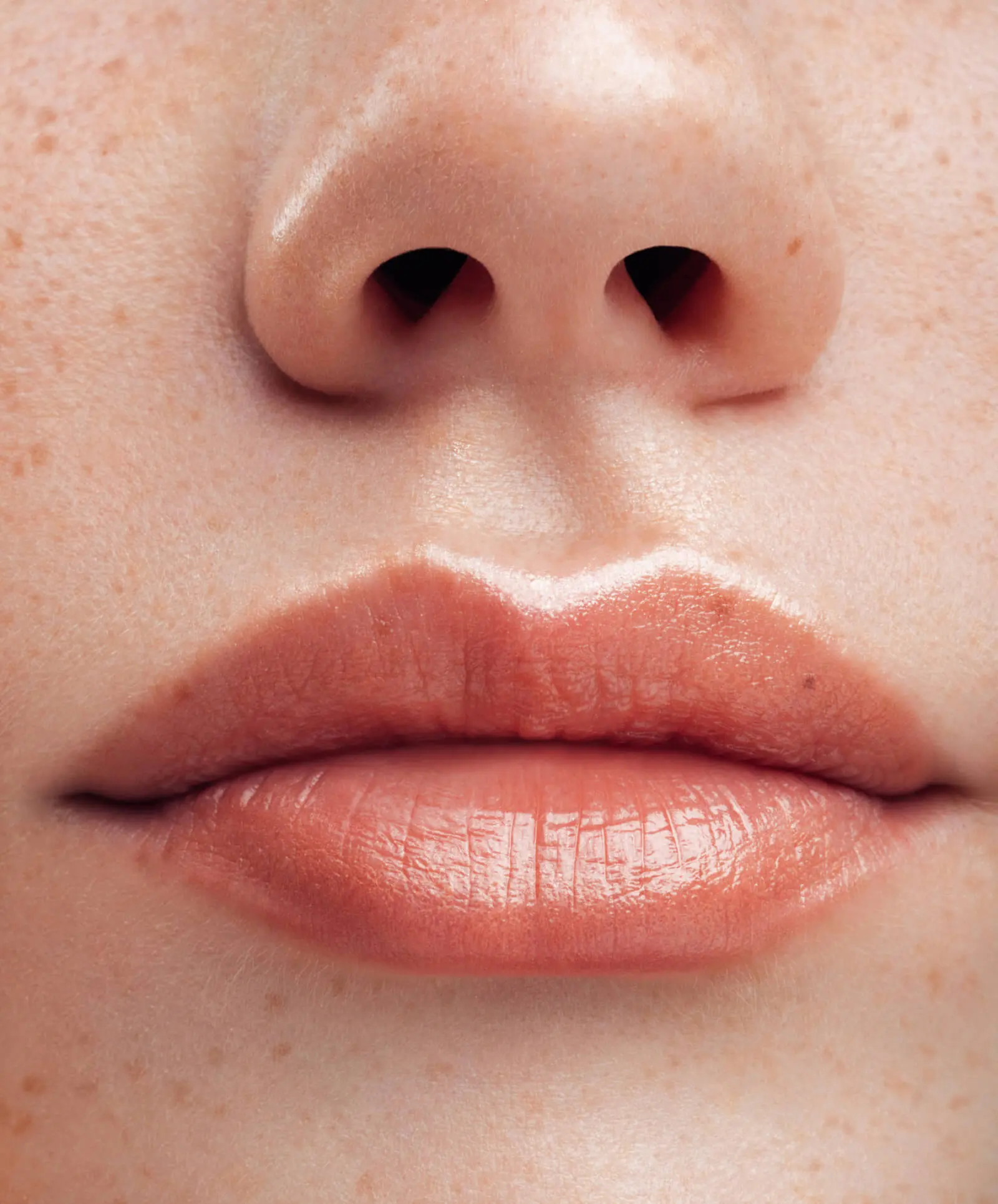 Lip Correction