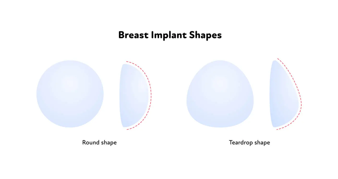 Anatomical Implants or Round Implants - Natural Results - Silicone Implants