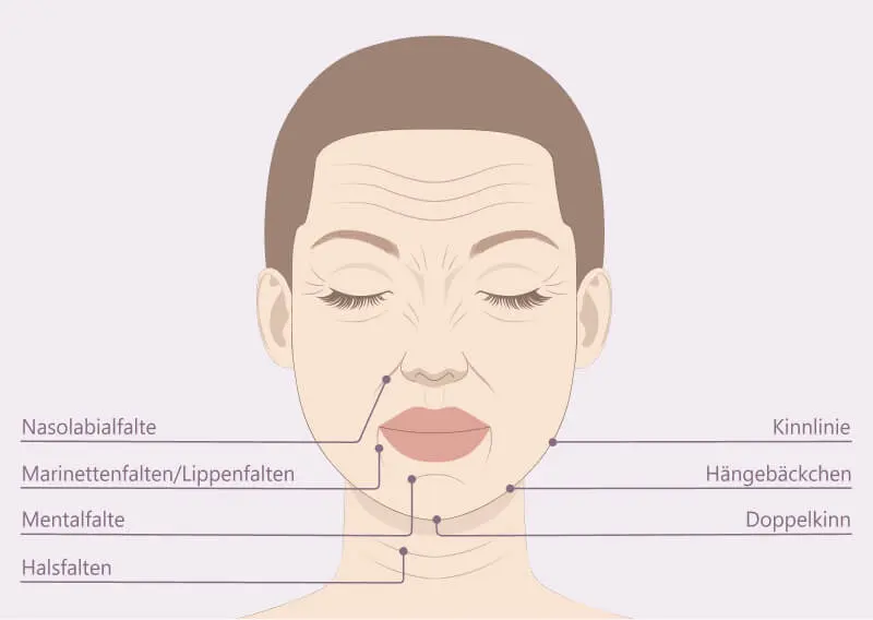 Types of wrinkles
