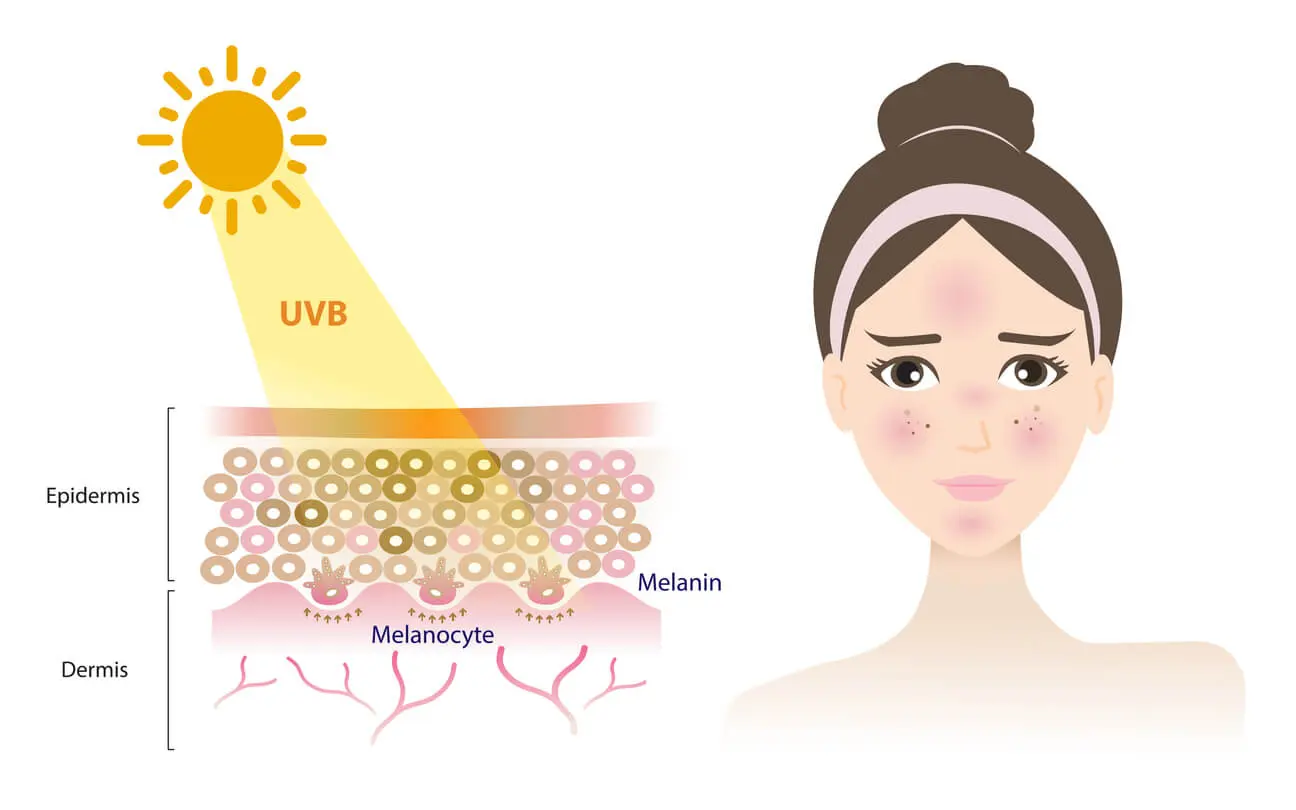 UV radiation forehead wrinkles
