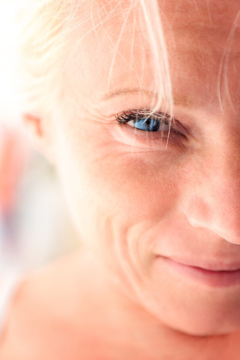 Augenfalten unterspritzen: Welche Behandlung ist sinnvoll?