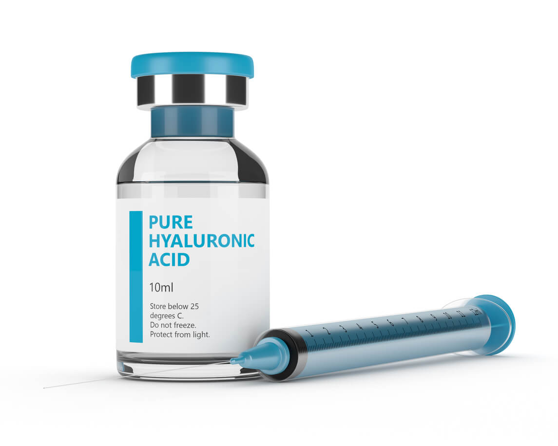 Hyaluronic acid injections for nasolabial folds