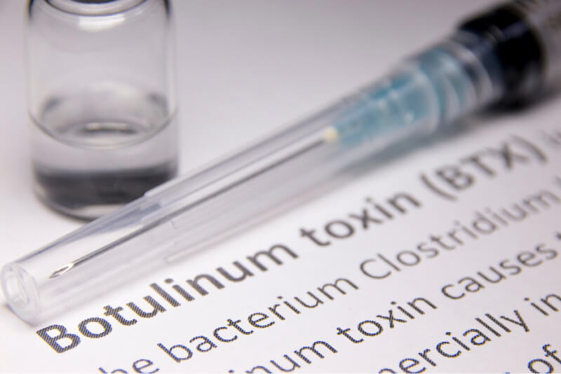 Trattamento delle rughe glabellari con Botox