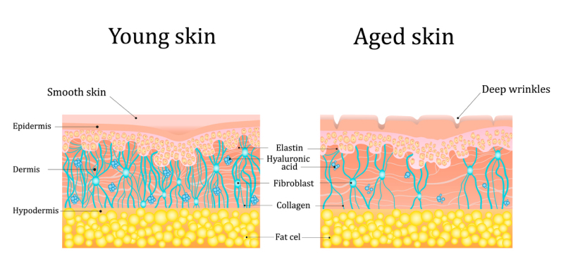 Wrinkle development later in life