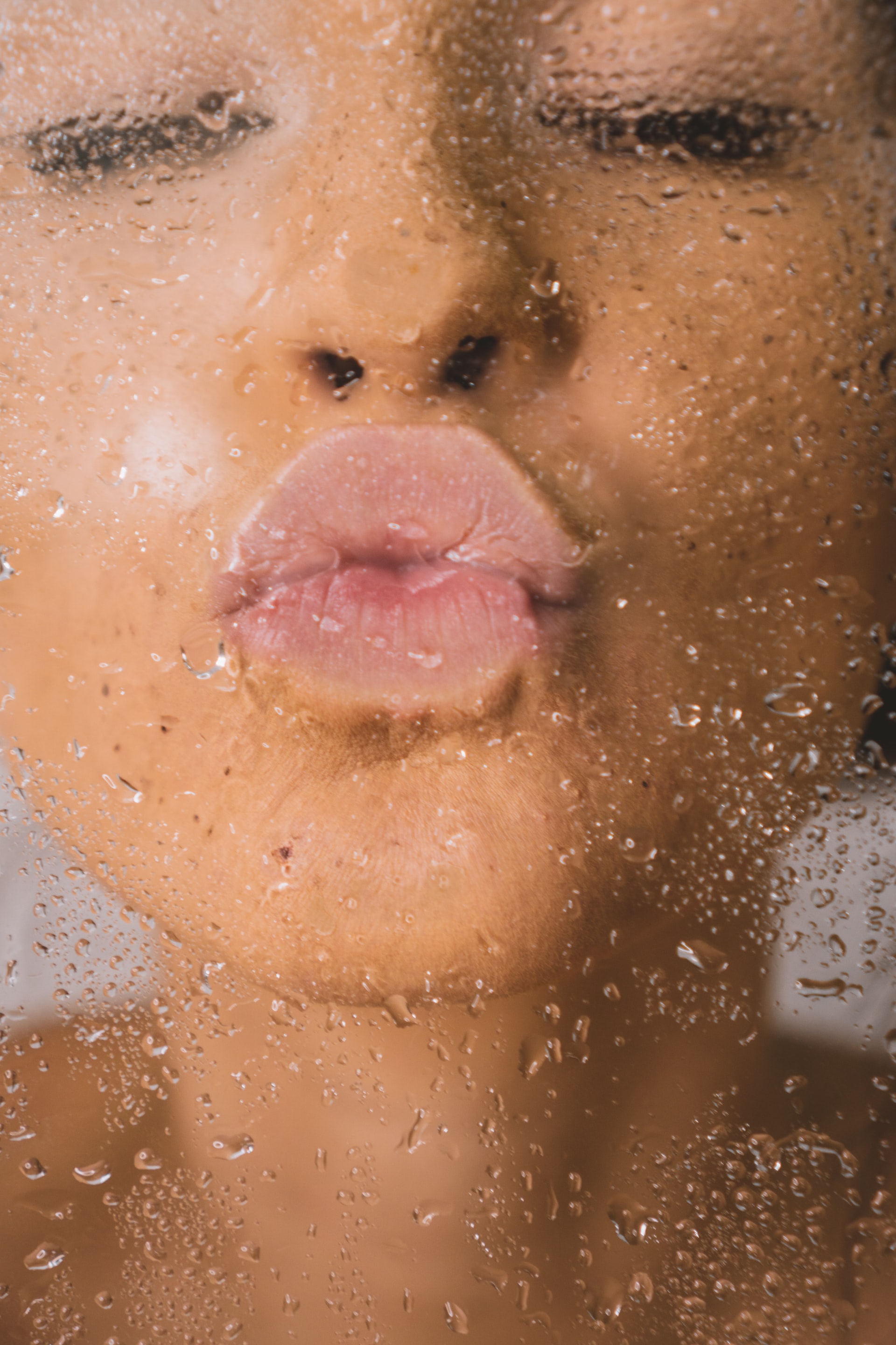 Lippenunterspritzung mit Eigenfett