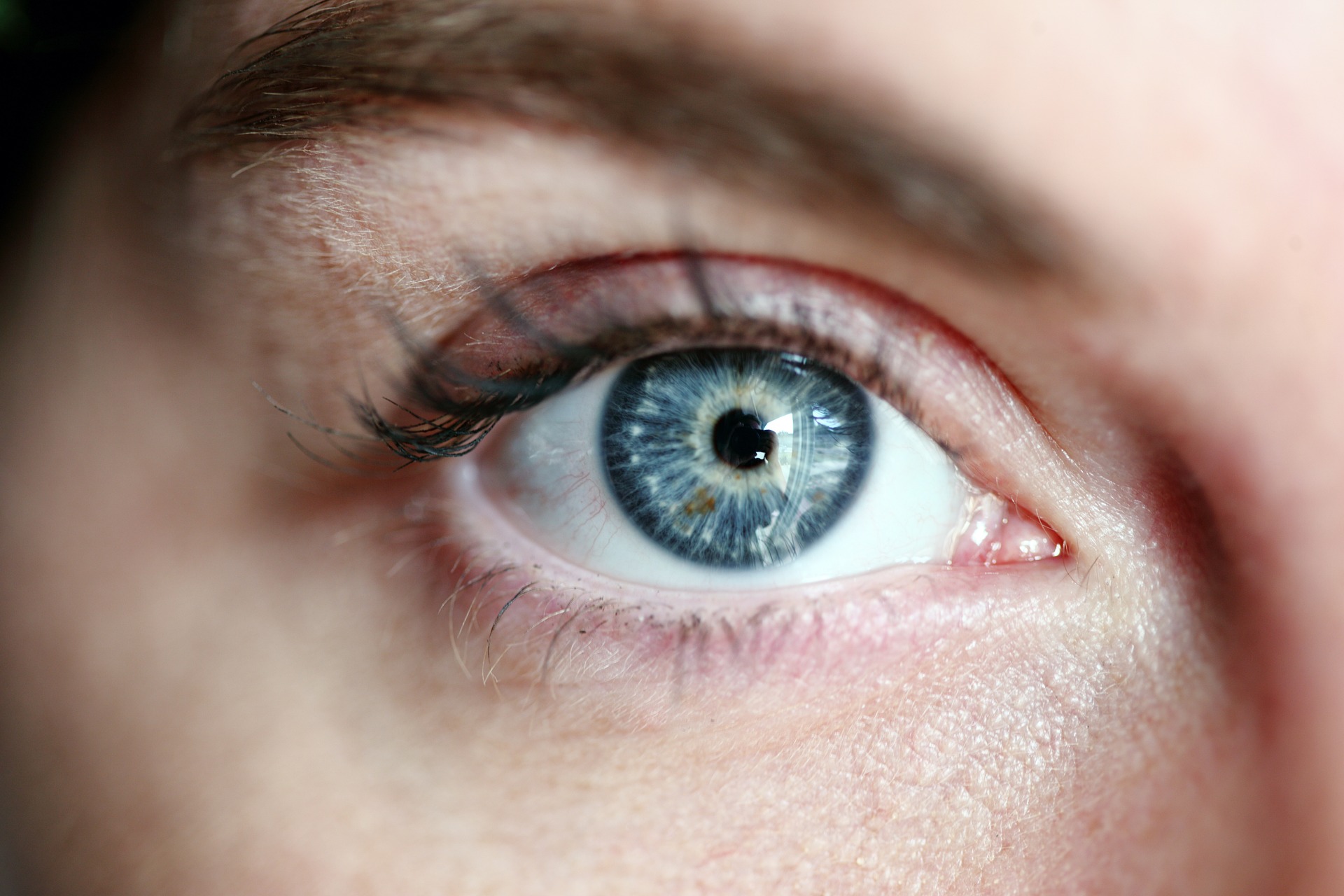 Hooded eyelid surgery in Berlin
