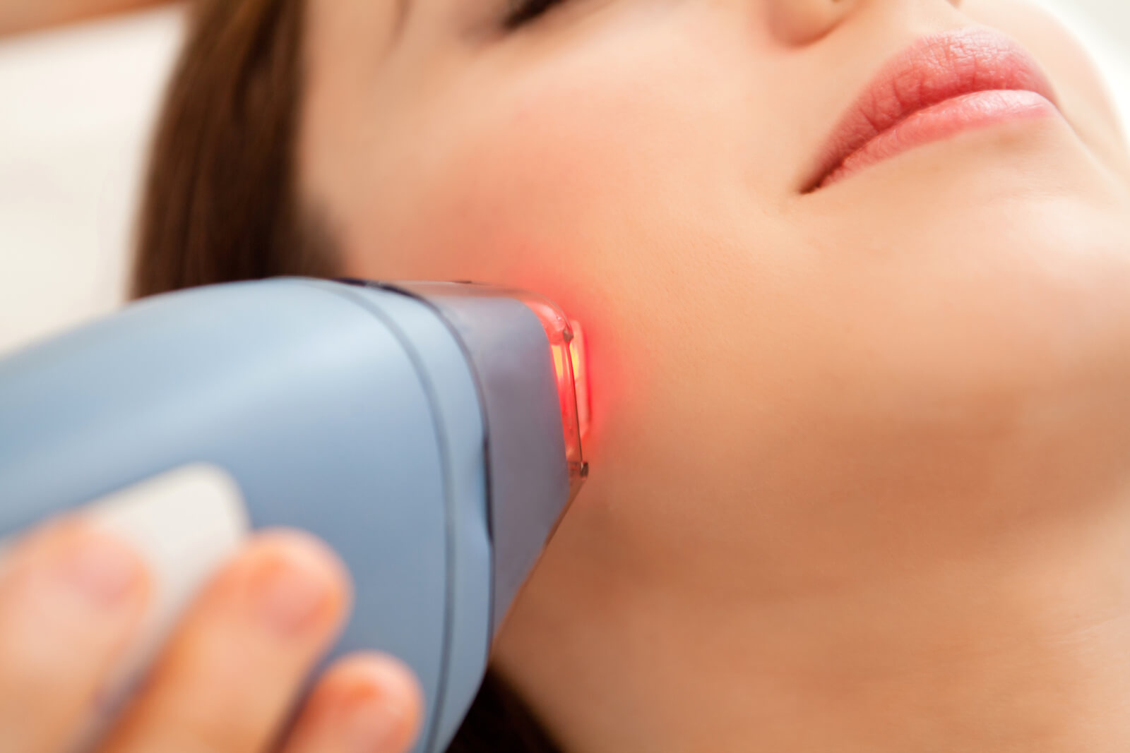 laserbehandlung