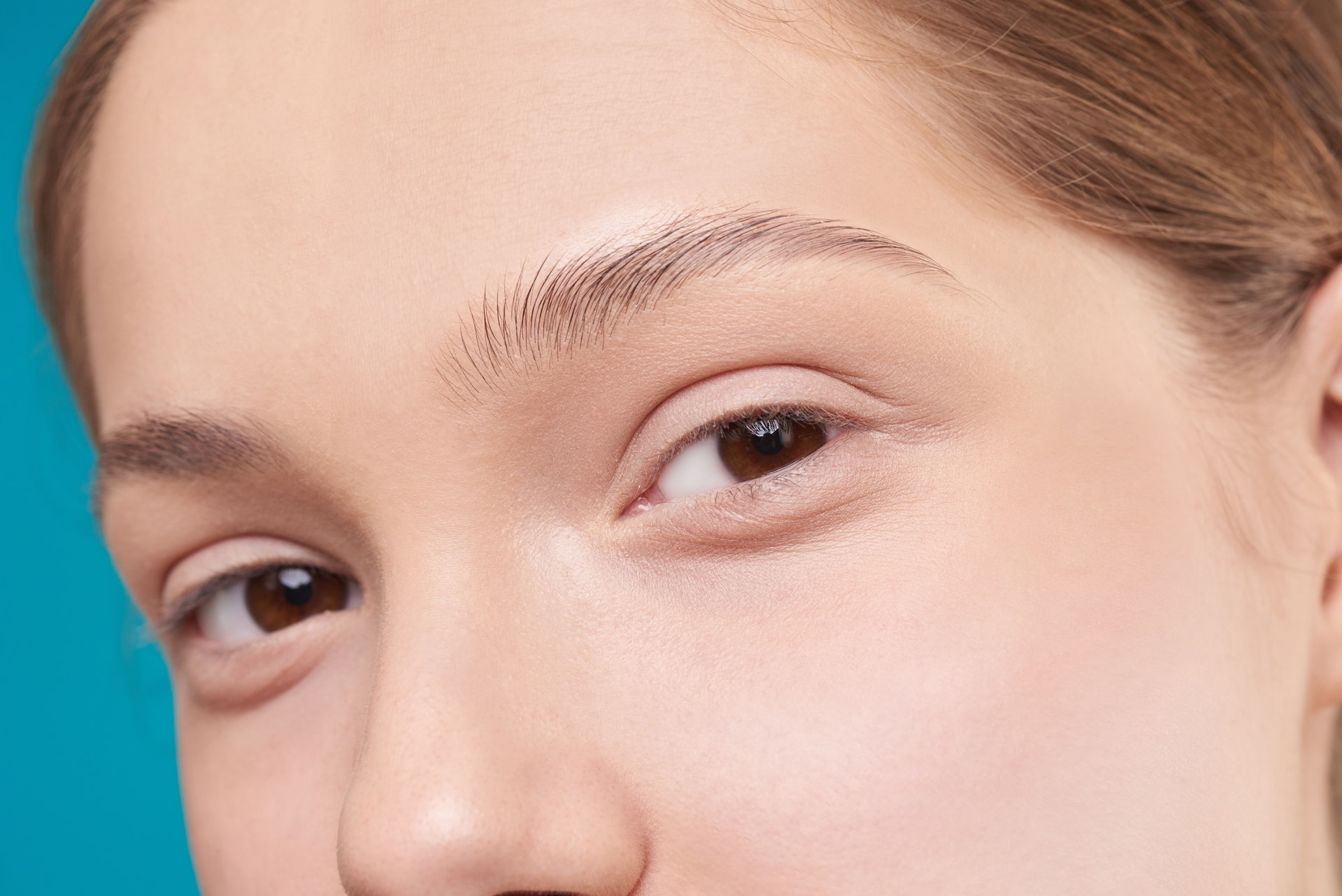 Brow Lift