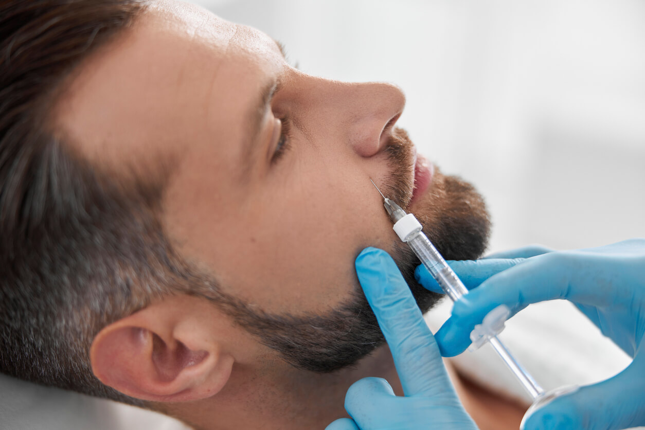 Treating nasolabial folds with hyaluronic acid