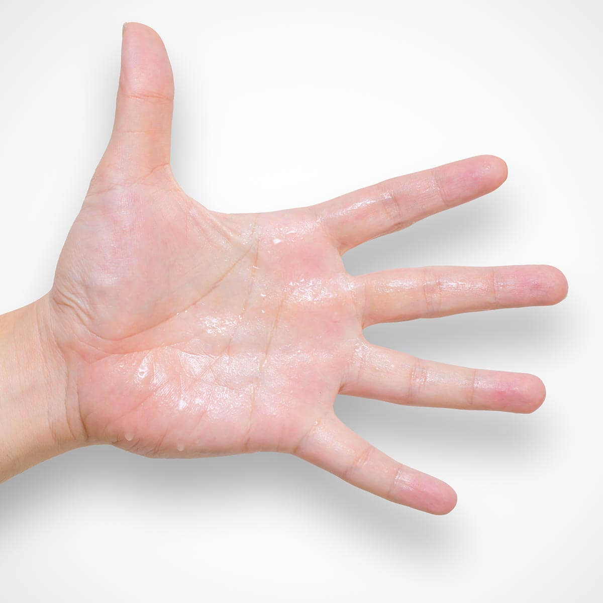 Treatment for excessive sweating of the hands and feet