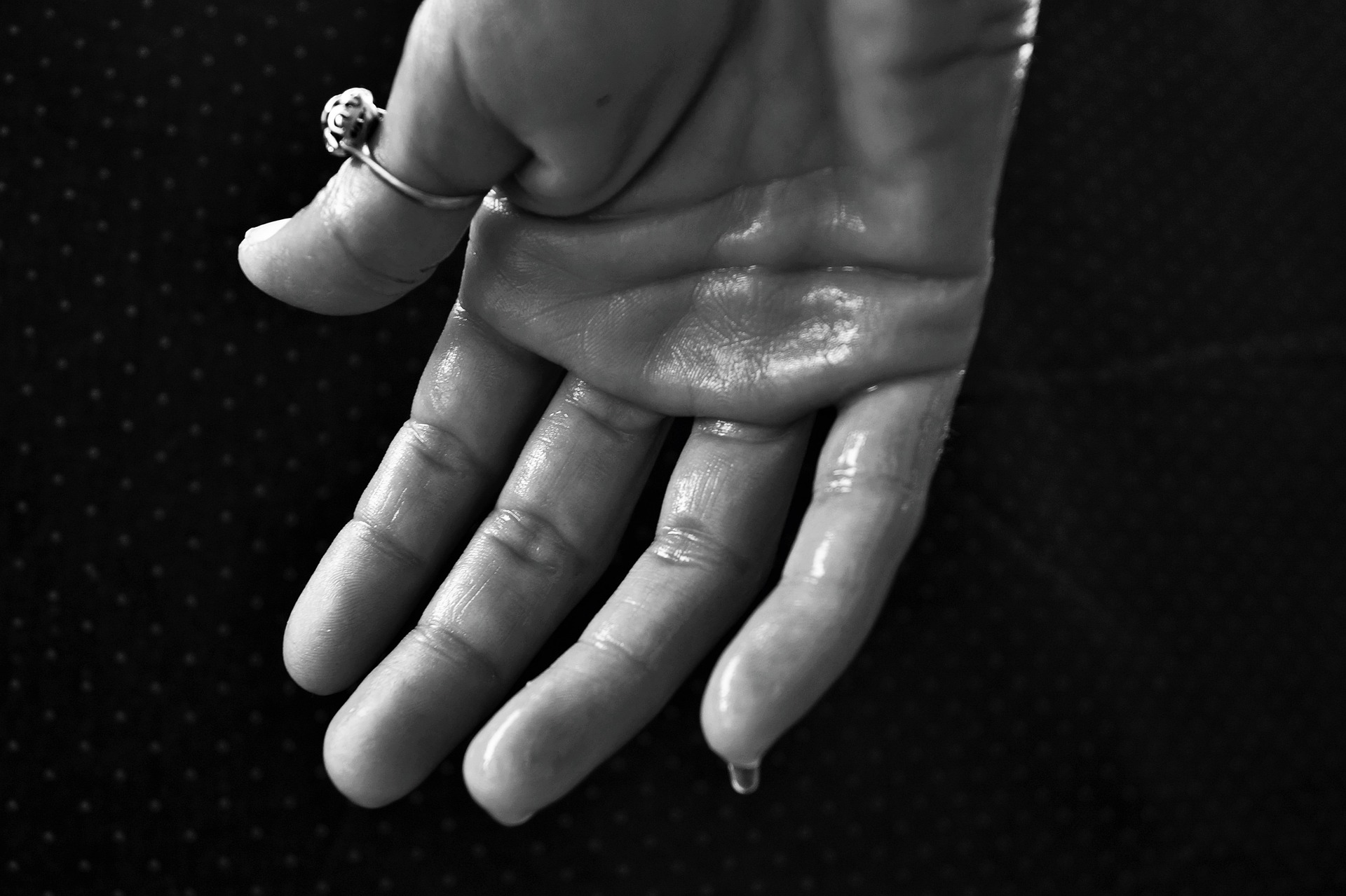 Hyperhidrose, Schweißhand, schwarz-weiß