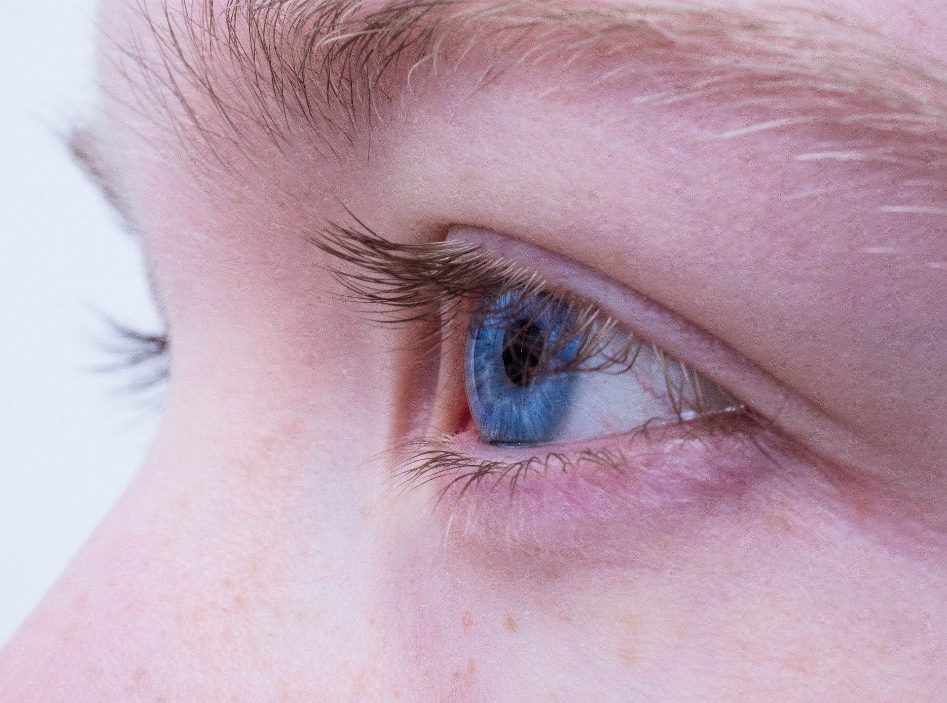 Eyelid lift in Berlin