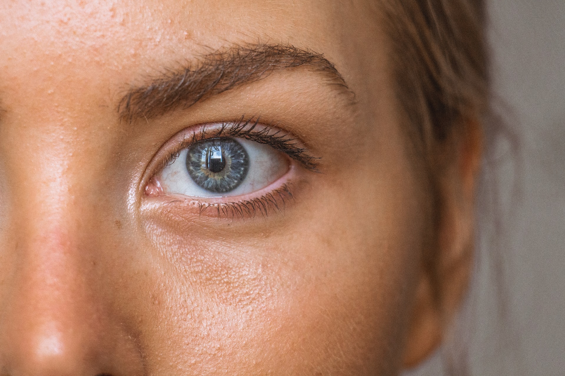 Lower eyelid lift in Berlin with Dottore Caletti