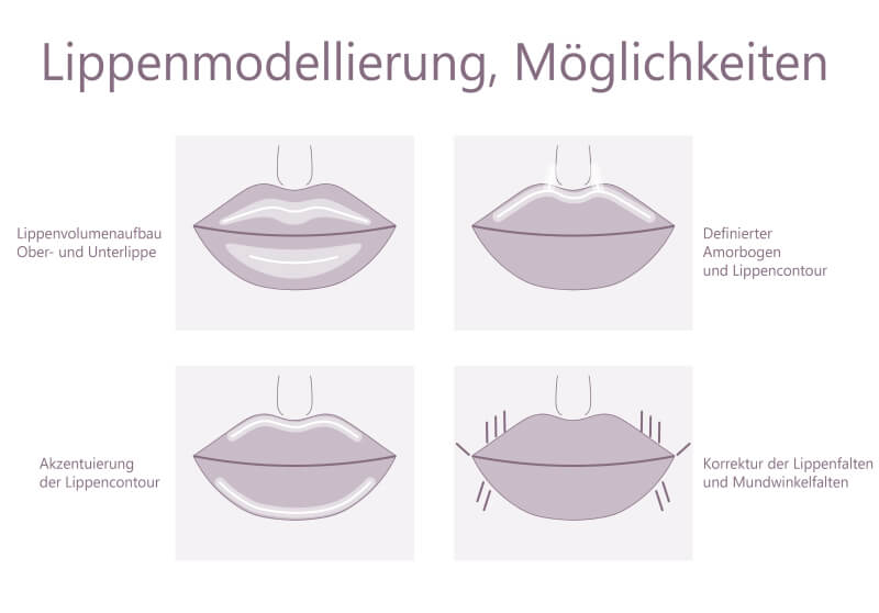 Lip shaping options