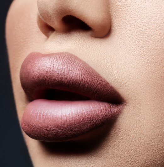 Overfilled lips