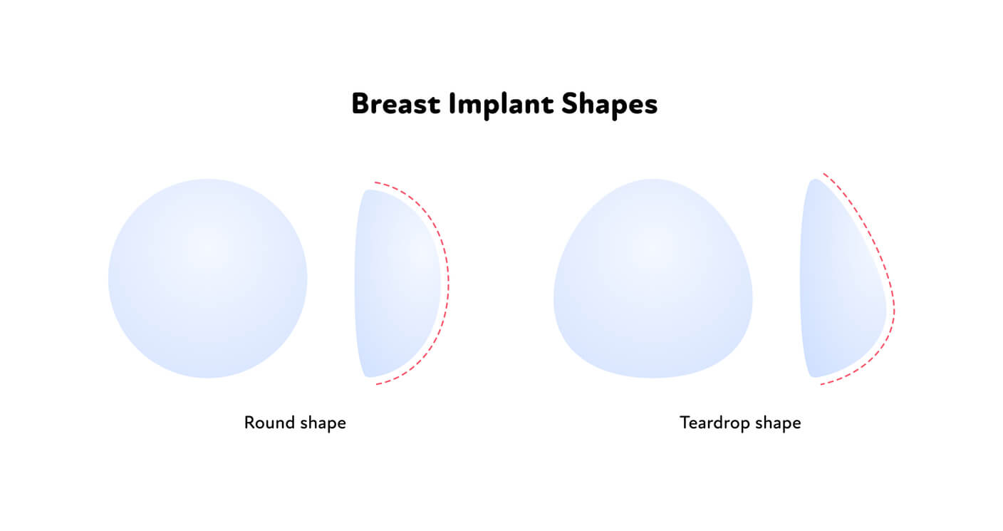 Anatomische Implantate oder Rund Implantate - Natürliches Ergabniss - Silikon Implantate