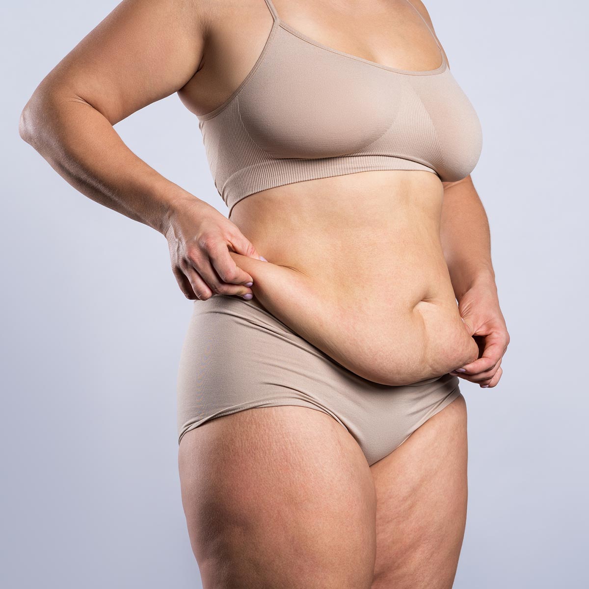 Hautüberschuss und erschlaffte Haut am Bauch-Plastische Chirurgie in Berlin- Abdominoplastik, Bauchdeckenstraffung