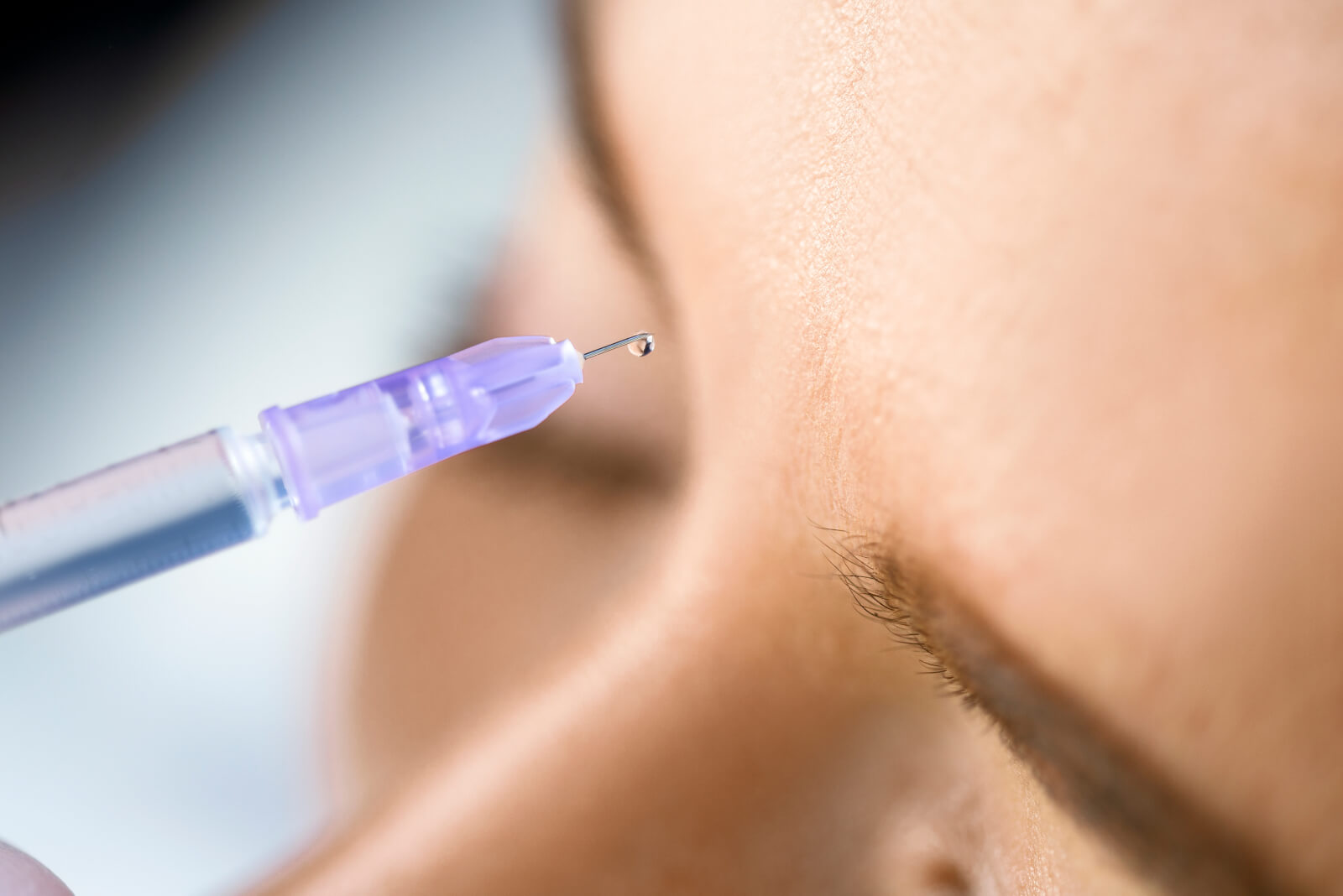 Faltenbehandlung mit Botox